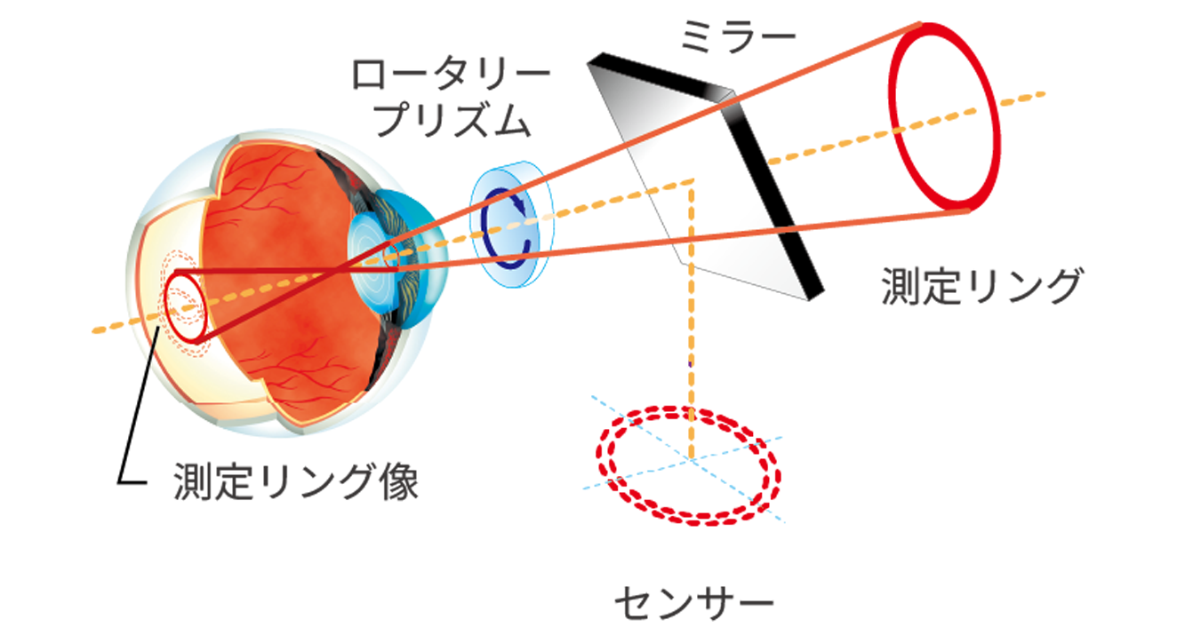 RM-1 - トプコンヘルスケア