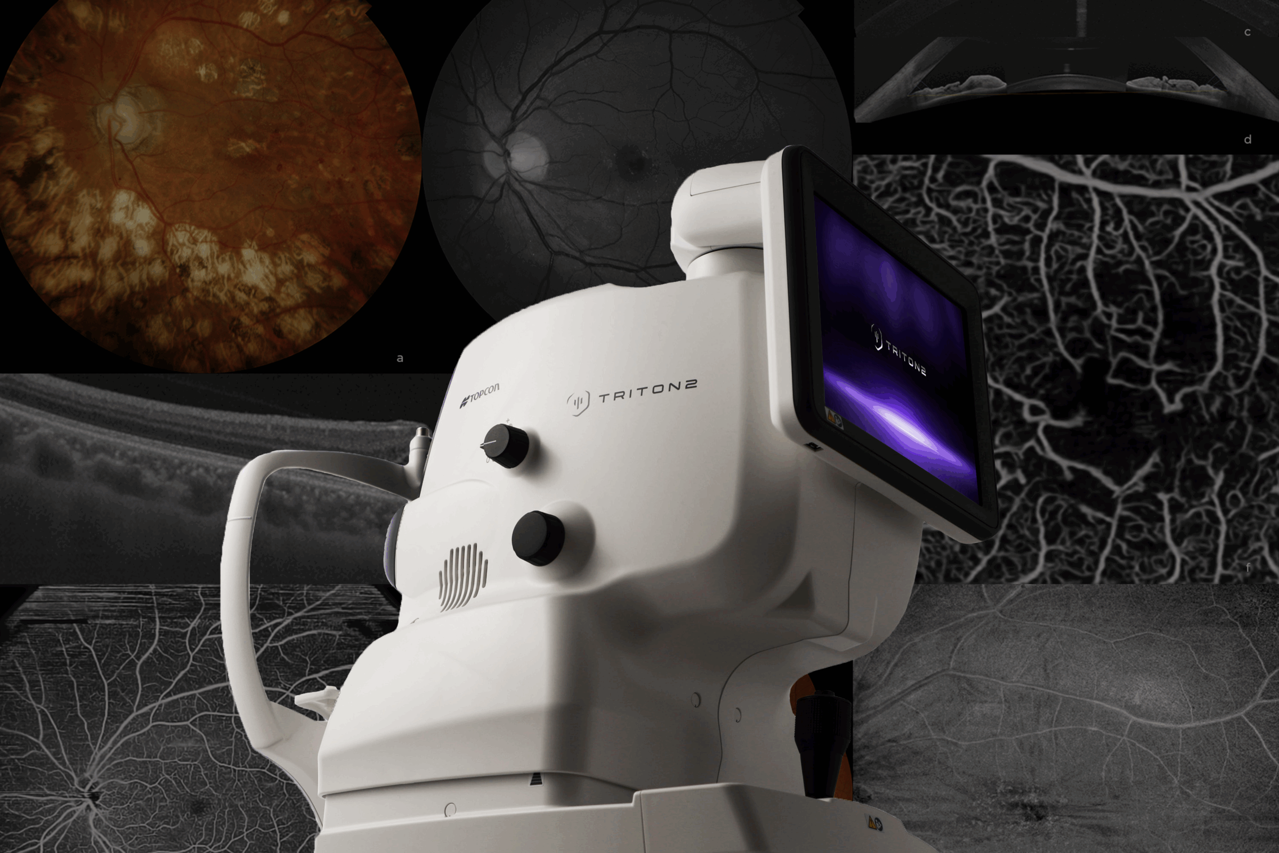 Triton2